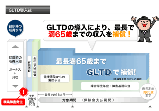 GLTD導入後